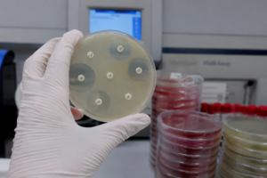 Resistencia a Antibióticos y Antifúngicos