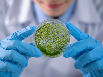 Especialización en Biotecnología en Microalgas