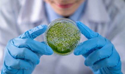 Especialización en Biotecnología en Microalgas